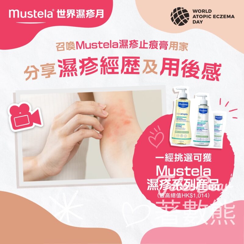分享濕疹經歷及用後感 送原枝 Mustela濕疹止痕膏 - Jetso Bear